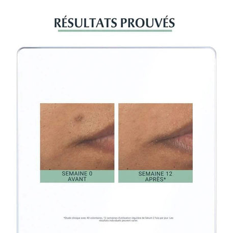 EUCERIN DermoPure Sérum Triple Action 40ml - Eucerin - Visage pour bébé Maroc -www.babyboss.ma