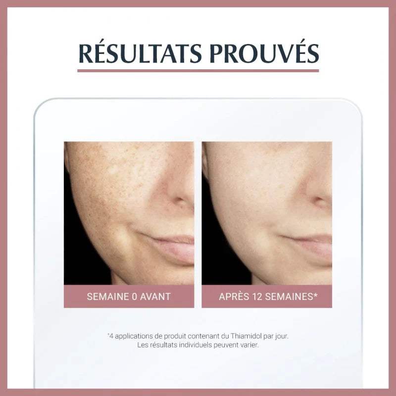 Eucerin Anti Pigment Sérum Éclat 30ml - Eucerin - pour bébé Maroc -www.babyboss.ma